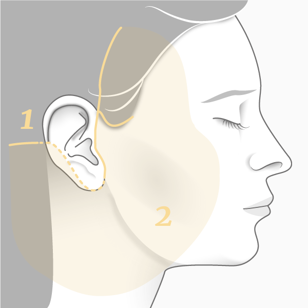 Lifting cervico-facial principe