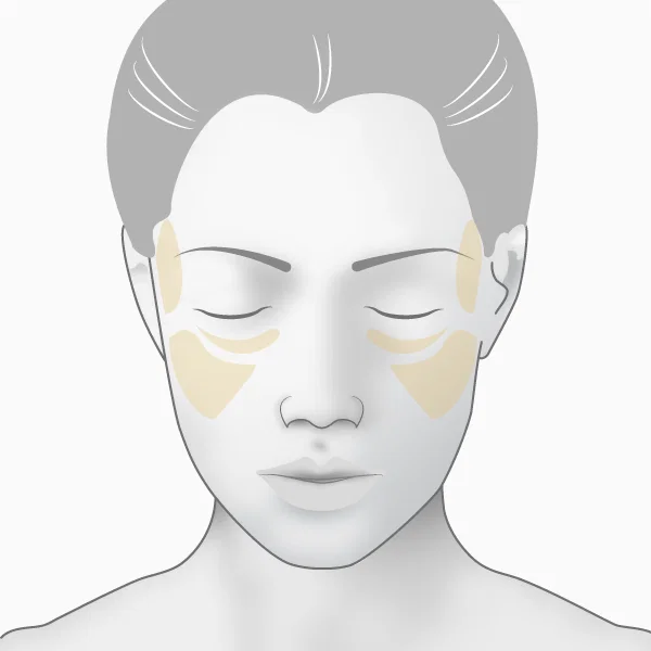 Illustration lipofilling